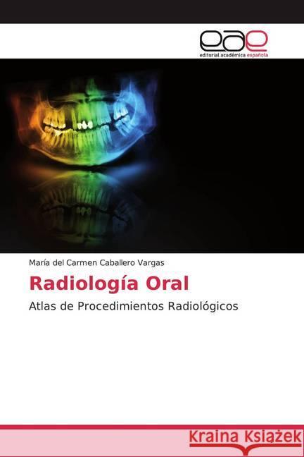 Radiología Oral : Atlas de Procedimientos Radiológicos Caballero Vargas, María del Carmen 9786202125376 Editorial Académica Española - książka