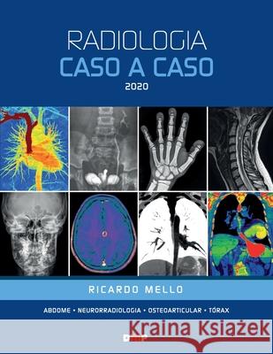 Radiologia Caso a Caso 2020 Ricardo Mello 9788566986037 Dmp - książka