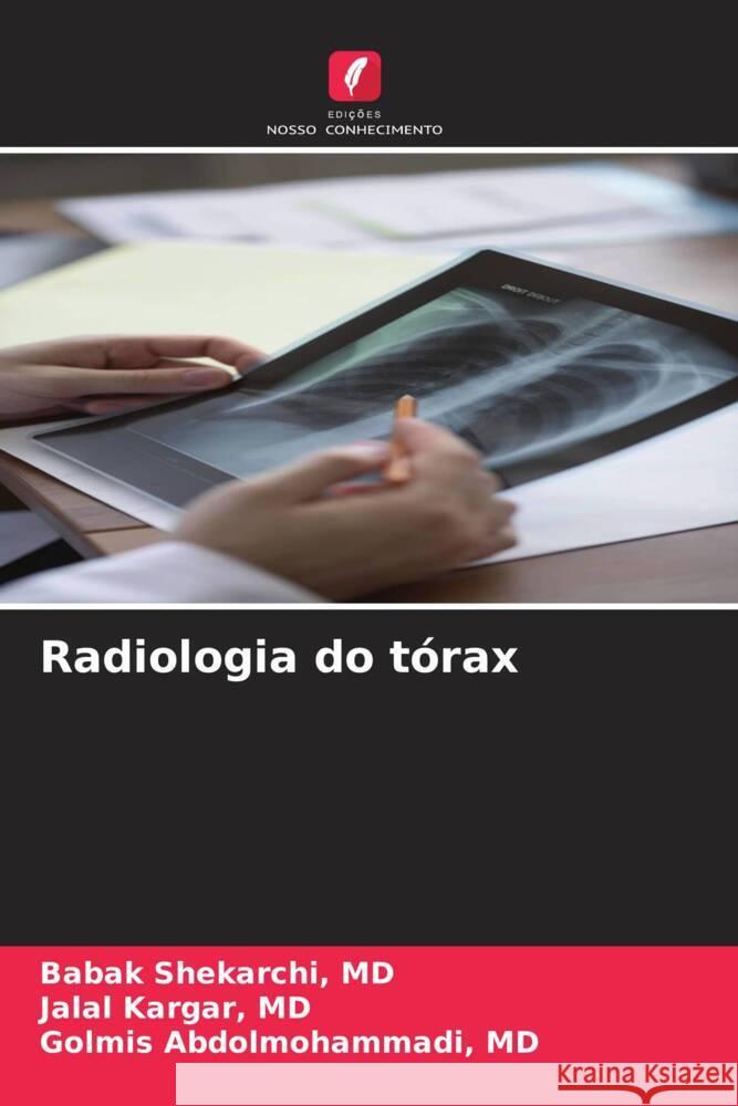 Radiologia do tórax Shekarchi, MD, Babak, Kargar, MD, Jalal, Abdolmohammadi, MD, Golmis 9786208642129 Edições Nosso Conhecimento - książka