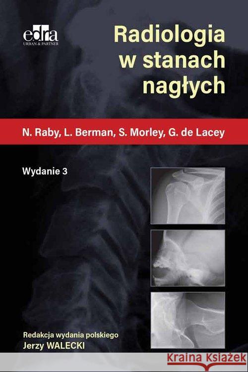 Radiologia w stanach nagłych N. Raby L. Berman S. Morley 9788366067219 Edra Urban & Partner - książka