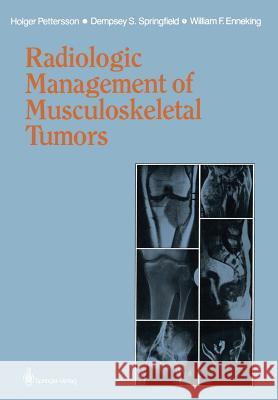 Radiologic Management of Musculoskeletal Tumors Holger Pettersson Dempsey S. Springfield William F. Enneking 9781447114208 Springer - książka