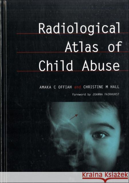 Radiological Atlas of Child Abuse: A Complete Resource for McQs, V. 1 Offiah, Amaka 9781846190438 Radcliffe Medical PR - książka