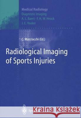 Radiological Imaging of Sports Injuries Carlo Masciocchi A. L. Baert C. Masciocchi 9783642643224 Springer - książka