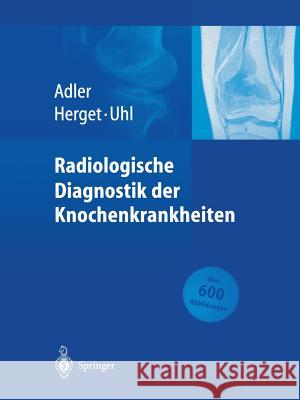 Radiologische Diagnostik Der Knochenkrankheiten Adler, Claus-Peter 9783662096611 Springer - książka