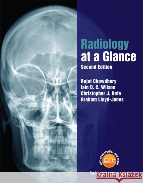 Radiology at a Glance Chowdhury, Rajat; Wilson, Iain; Rofe, Christopher 9781118914779 John Wiley & Sons - książka