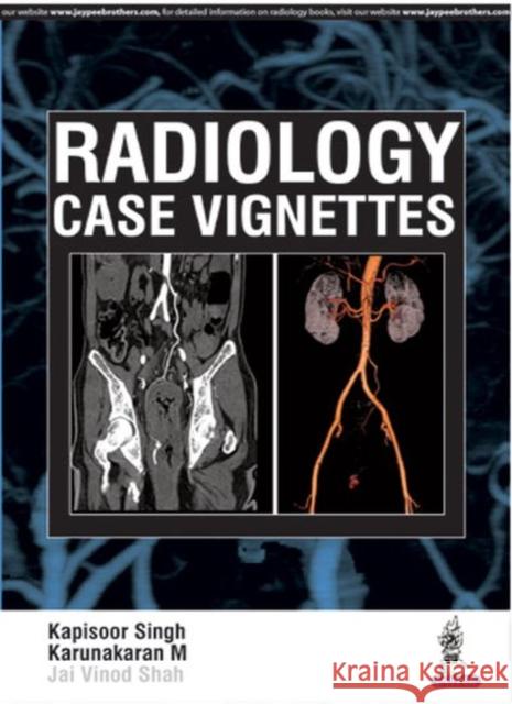 Radiology Case Vignettes Singh, Kapisoor|||Shah, Jai Vinod 9789385891045  - książka