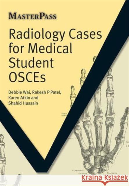 Radiology Cases for Medical Student Osces Wai, Debbie 9781846194528 MasterPass Series - książka