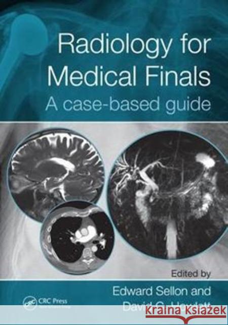 Radiology for Medical Finals: A Case-Based Guide Edward Sellon David Howlett 9781498782166 CRC Press - książka