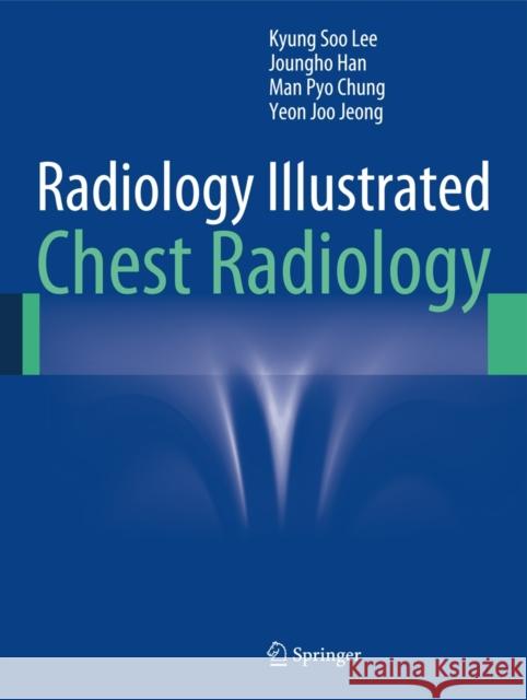 Radiology Illustrated: Chest Radiology Kyung Soo Lee 9783642370953 Springer - książka