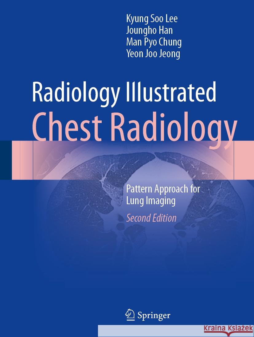 Radiology Illustrated: Chest Radiology: Pattern Approach for Lung Imaging Kyung Soo Lee Joungho Han Man Pyo Chung 9789819966325 Springer - książka
