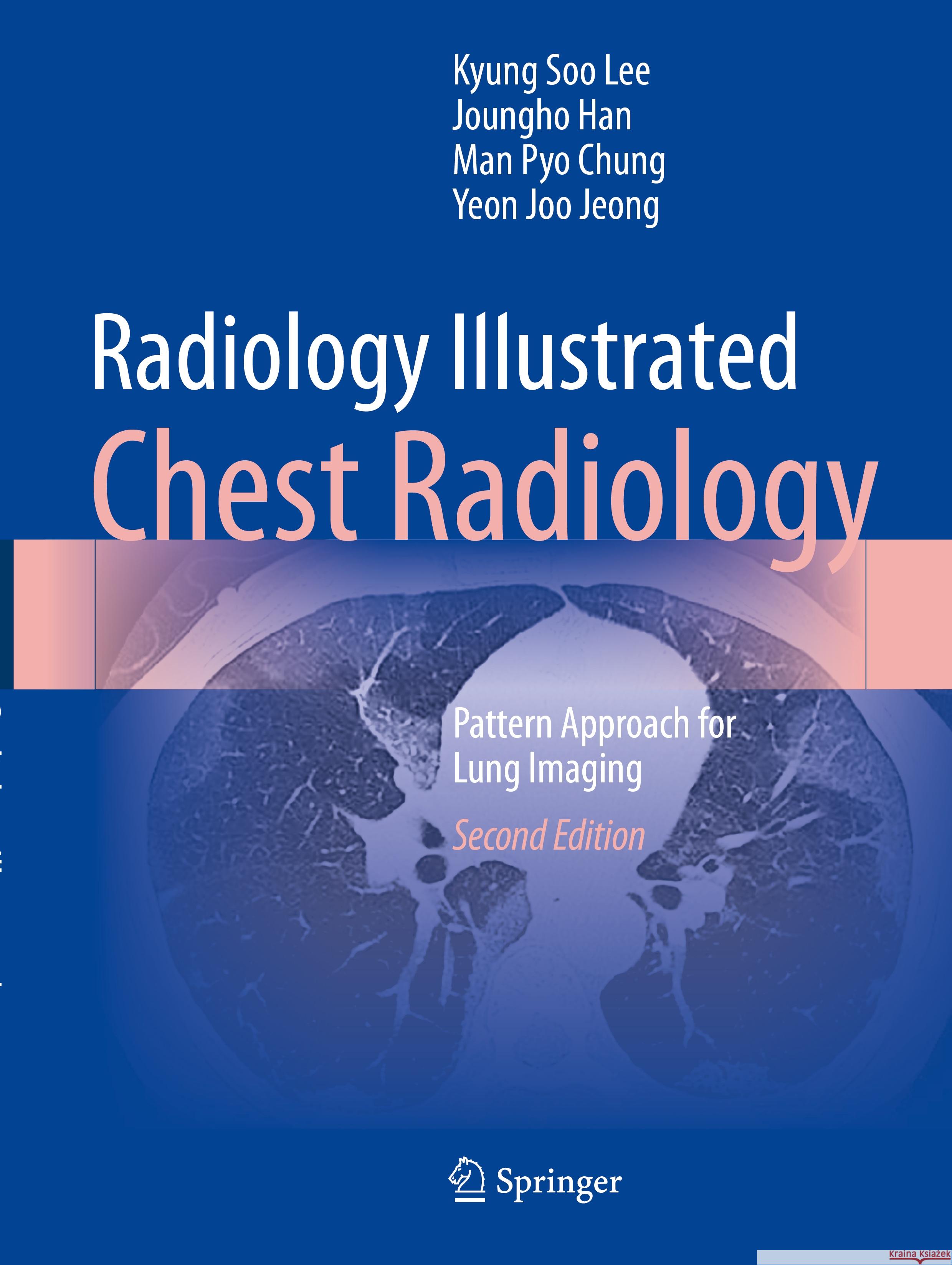 Radiology Illustrated: Chest Radiology: Pattern Approach for Lung Imaging Kyung Soo Lee, Joungho Han, Man Pyo Chung 9789819966356 Springer Verlag, Singapore - książka