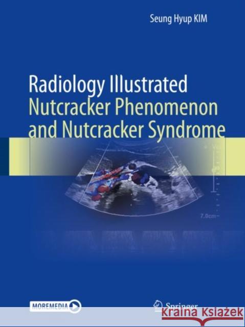 Radiology Illustrated: Nutcracker Phenomenon and Nutcracker Syndrome Seung Hyup Kim 9789811662171 Springer Singapore - książka