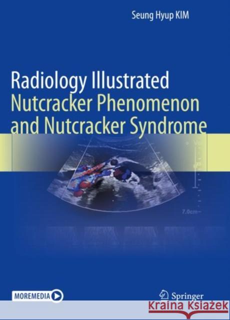 Radiology Illustrated: Nutcracker Phenomenon and Nutcracker Syndrome Seung Hyup Kim 9789811662201 Springer - książka