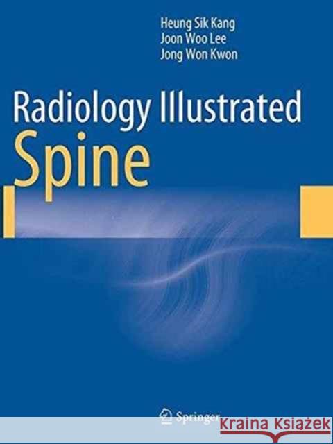 Radiology Illustrated: Spine Heung Sik Kang Joon Woo Lee Jong Won Kwon 9783662522837 Springer - książka