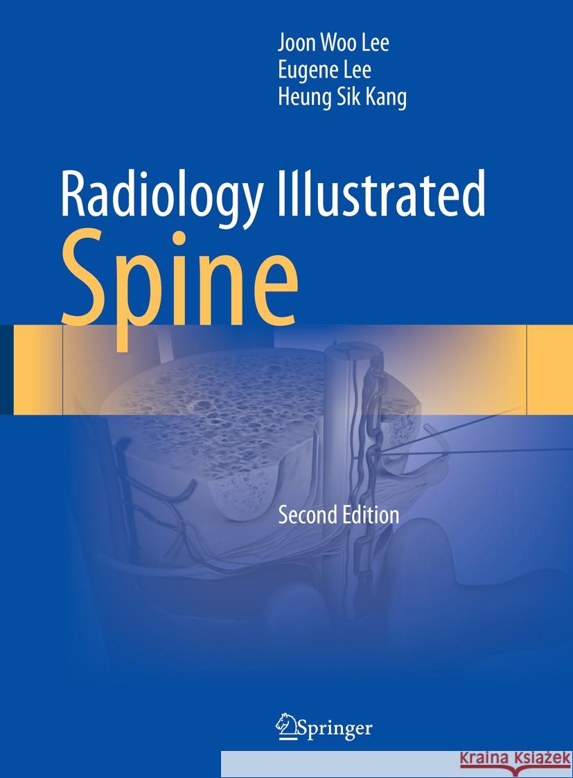 Radiology Illustrated: Spine Joon Woo Lee Eugene Lee Heung Sik Kang 9789819966110 Springer - książka