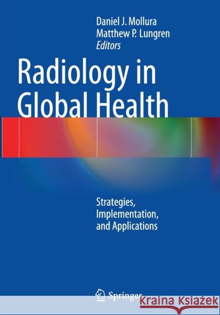 Radiology in Global Health: Strategies, Implementation, and Applications Mollura, Daniel J. 9781493952366 Springer - książka