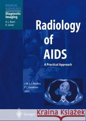 Radiology of AIDS J. W. A. J. Reeders P. C. Goodman A. L. Baert 9783642630606 Springer - książka