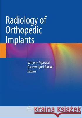 Radiology of Orthopedic Implants Sanjeev Agarwal Gaurav Jyoti Bansal 9783030093785 Springer - książka