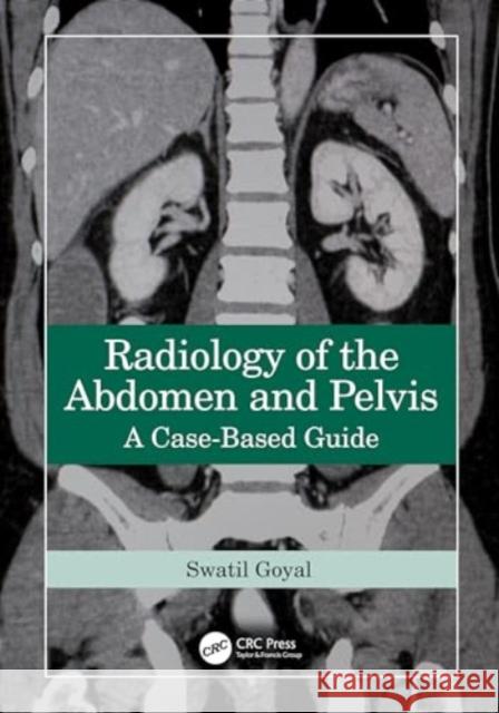 Radiology of the Abdomen and Pelvis: A Case-Based Guide Swati Goyal 9781032588780 CRC Press - książka