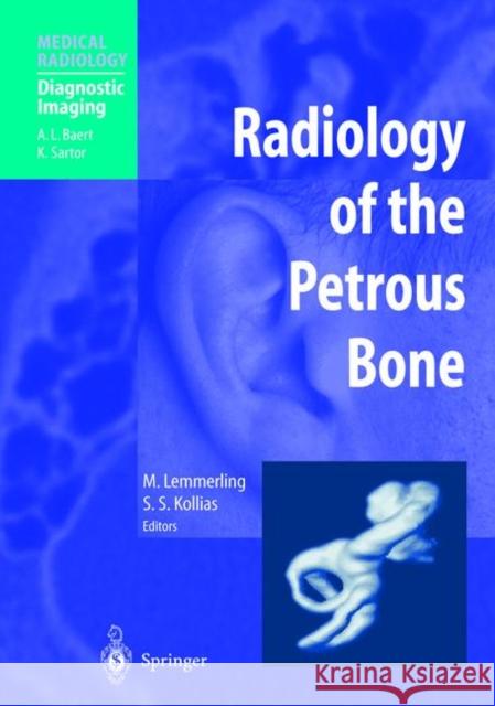 Radiology of the Petrous Bone Marc Lemmerling Spyros S. Kollias 9783642623158 Springer - książka