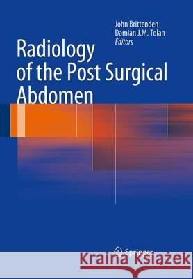 Radiology of the Post Surgical Abdomen John Brittenden Damian J. M. Tolan 9781447168461 Springer - książka