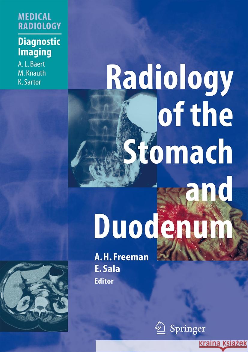 Radiology of the Stomach and Duodenum Alan H. Freeman E. Sala A. L. Baert 9783662496053 Springer - książka