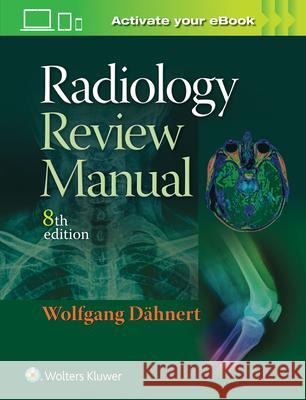 Radiology Review Manual Wolfgang F. Dahnert 9781496360694 Lippincott Williams and Wilkins - książka