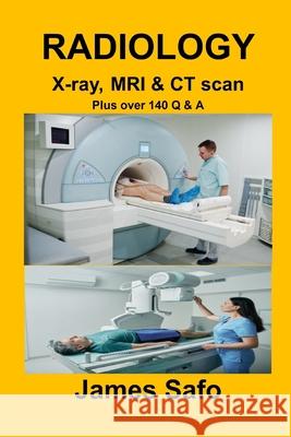 RADIOLOGY X-ray, MRI & CT scan: Plus over 140 Q & A James Safo 9781917753128 Faith Unity Books - książka
