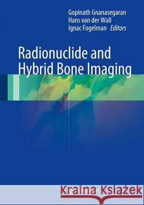Radionuclide and Hybrid Bone Imaging  Fogelman 9783642023996 Springer, Berlin - książka