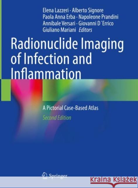 Radionuclide Imaging of Infection and Inflammation: A Pictorial Case-Based Atlas Elena Lazzeri Alberto Signore Paola Anna Erba 9783030621742 Springer - książka