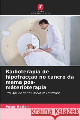 Radioterapia de hipofrac??o no cancro da mama p?s-m?terioterapia Peter Rotich 9786205752777 Edicoes Nosso Conhecimento - książka