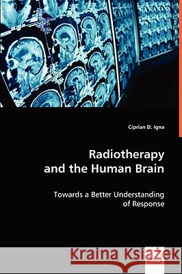Radiotherapy and the Human Brain Ciprian D. Igna 9783639046762 VDM VERLAG DR. MULLER AKTIENGESELLSCHAFT & CO - książka