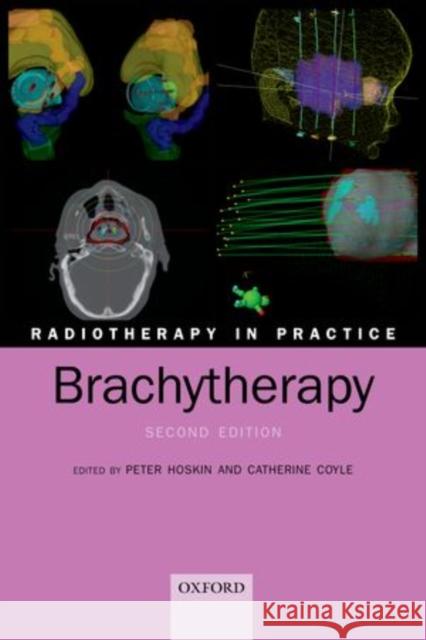 Radiotherapy in Practice - Brachytherapy Peter J Hoskin 9780199600908  - książka