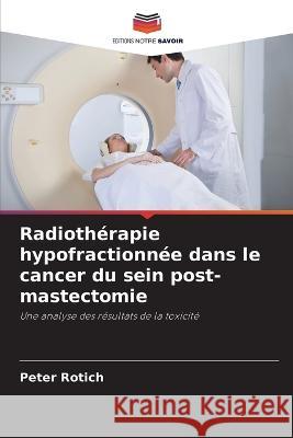 Radioth?rapie hypofractionn?e dans le cancer du sein post-mastectomie Peter Rotich 9786205752661 Editions Notre Savoir - książka