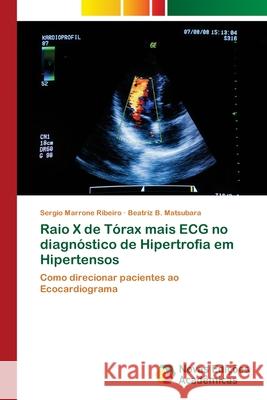 Raio X de Tórax mais ECG no diagnóstico de Hipertrofia em Hipertensos Marrone Ribeiro, Sergio 9786202181365 Novas Edicioes Academicas - książka