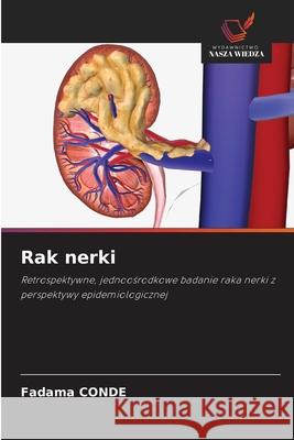 Rak nerki CONDE, Fadama 9786202002998 Wydawnictwo Nasza Wiedza - książka