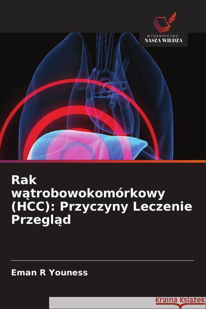 Rak watrobowokomórkowy (HCC): Przyczyny Leczenie Przeglad Youness, Eman R 9786208341152 Wydawnictwo Nasza Wiedza - książka