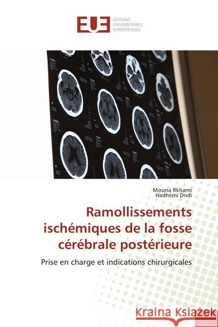 Ramollissements ischémiques de la fosse cérébrale postérieure : Prise en charge et indications chirurgicales Rkhami, Mouna; Dridi, Hadhémi 9786138433804 Éditions universitaires européennes - książka