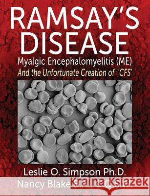 Ramsay's Disease - Myalgic Encephalomyelitis (Me) and the Unfortunate Creation of 'Cfs' Simpson, Leslie O. 9780957181724 Lifelight Publishing - książka