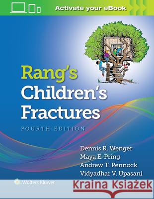 Rang's Children's Fractures Dennis Wenger 9781496368157 LWW - książka