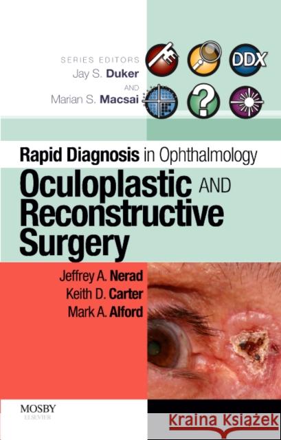 Rapid Diagnosis in Ophthalmology Series: Oculoplastic and Reconstructive Surgery Jeffrey A. Nerad Keith D. Carter Mark Alford 9780323053860 Mosby - książka