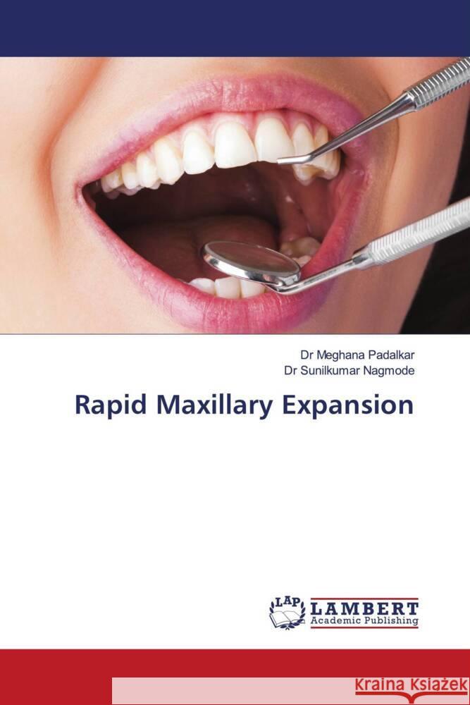 Rapid Maxillary Expansion Padalkar, Dr Meghana, Nagmode, Dr Sunilkumar 9786202679503 LAP Lambert Academic Publishing - książka