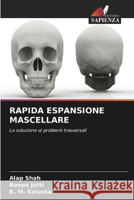 Rapida Espansione Mascellare Alap Shah Roopa Jatti K M Keluskar 9786205315392 Edizioni Sapienza - książka