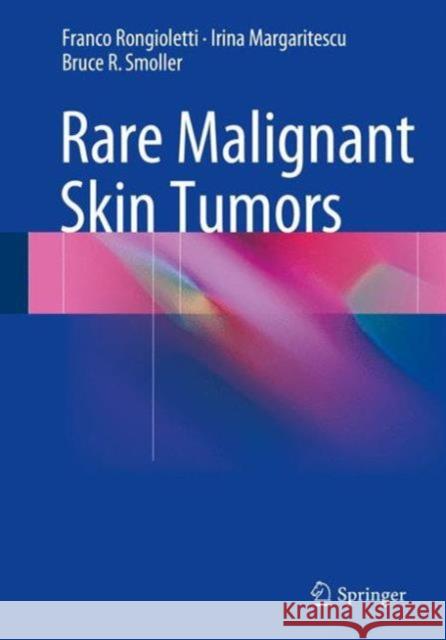 Rare Malignant Skin Tumors Franco Rongioletti Irina Margaritescu Bruce R. Smoller 9781493920228 Springer - książka