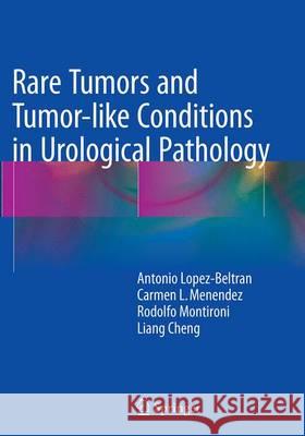 Rare Tumors and Tumor-Like Conditions in Urological Pathology Lopez-Beltran, Antonio 9783319378718 Springer - książka