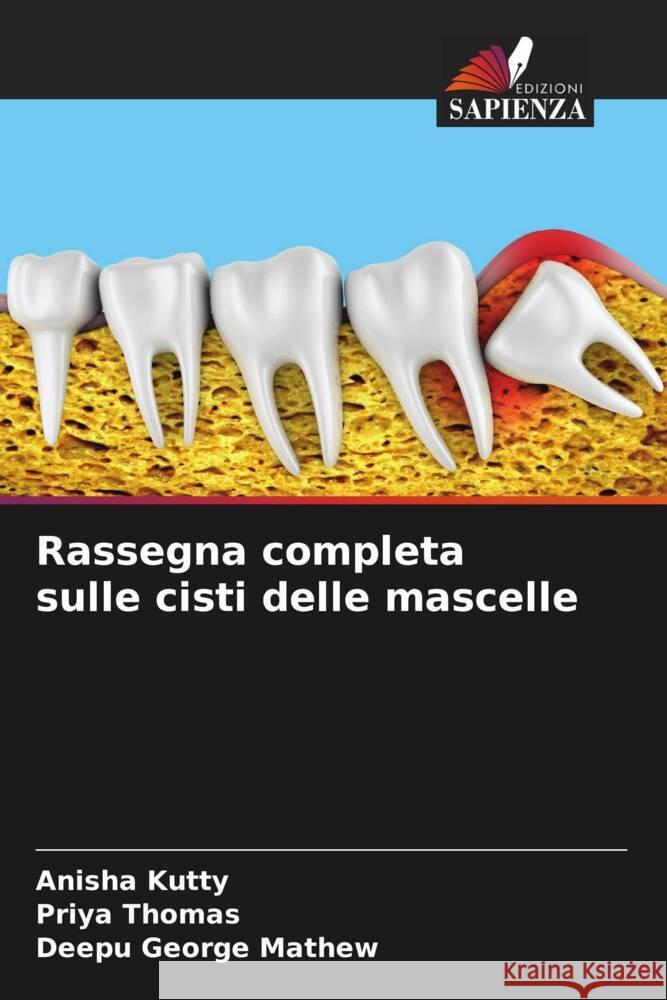 Rassegna completa sulle cisti delle mascelle Anisha Kutty Priya Thomas Deepu George Mathew 9786206049524 Edizioni Sapienza - książka