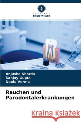 Rauchen und Parodontalerkrankungen Anjusha Sharda, Sanjay Gupta, Neelu Verma 9786204084220 Verlag Unser Wissen - książka