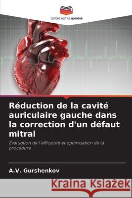 Réduction de la cavité auriculaire gauche dans la correction d'un défaut mitral Gurshenkov, A. V. 9786203064865 Editions Notre Savoir - książka