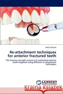 Re-attachment techniques for anterior fractured teeth Mujeeb, Abdul 9783659190773 LAP Lambert Academic Publishing - książka