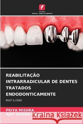 Reabilitacao Intrarradicular de Dentes Tratados Endodonticamente Priya Mishra Ajay Kumar Nagpal  9786206027362 Edicoes Nosso Conhecimento - książka